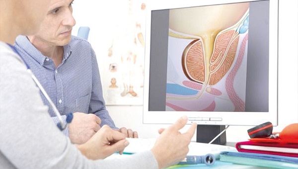 Vacuna para tratar y prevenir el cáncer de próstata