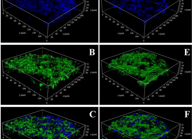 Biopolymer Glycopolypeptide Blended Scaffolds
