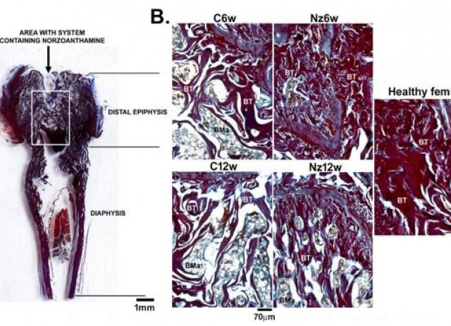 Osteoprotective effect of the marine alkaloid norzoanthamine on an osteoporosis model in ovariectomized rat