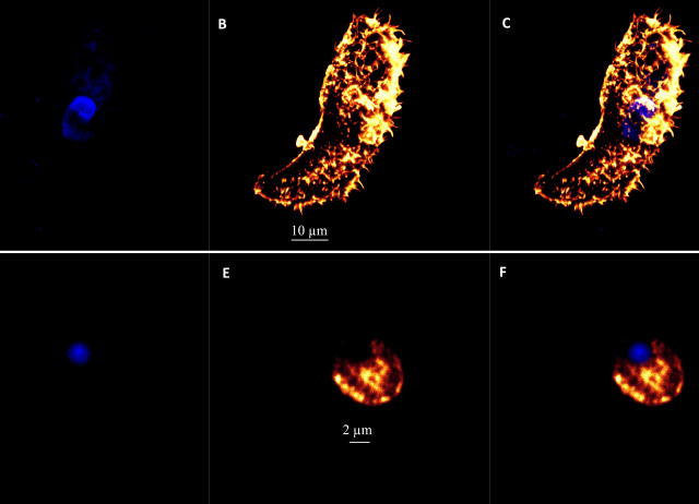 Amoebicidal effect of synthetic indoles against Acanthamoeba spp.: a study of cell death